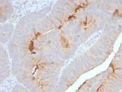 Serum Amyloid A1/A2 Antibody (SAA/2868R) - Azide and BSA Free, Novus Biologicals